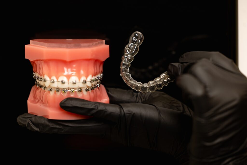 mouth guard and models of teeth with braces on teeth on a jaw
